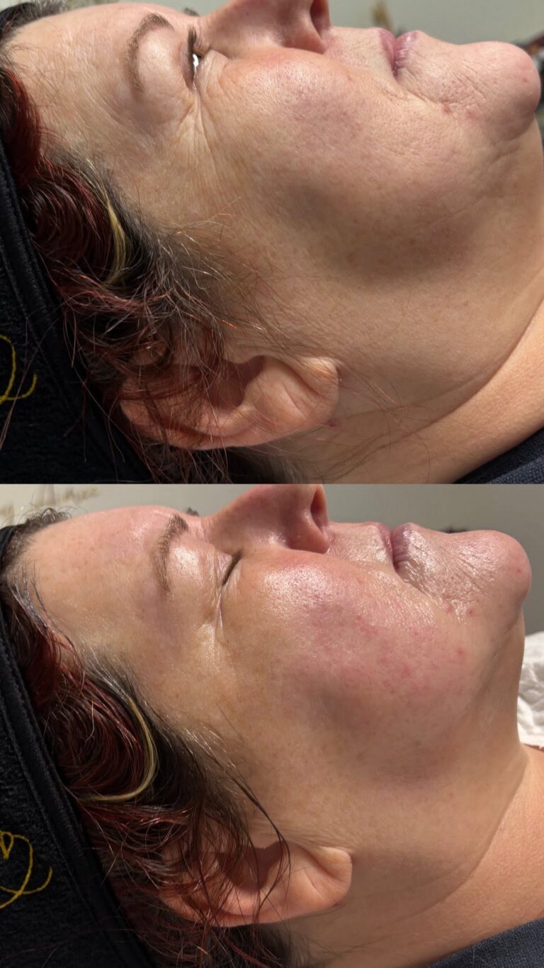 facials 1